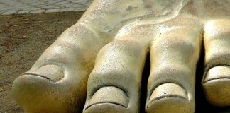 Giht – bolest kraljeva Giht