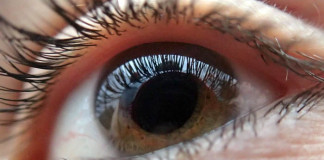 Katarakta – siva mrena Katarakt