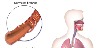 Akutni bronhitis: zviždanje u grudima uz temperaturu