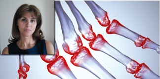 Dr Gorica Ristić: Sve što treba da znate o reumi