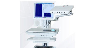 EMNG – moćan alat za otkrivanje problema sa mišićima i nervima