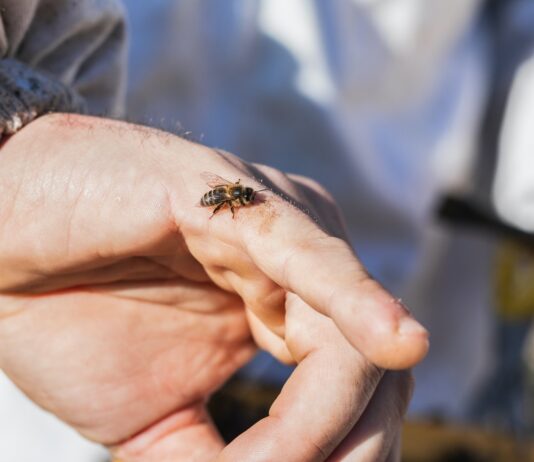 Anafilaksa – po život opasna alergijska reakcija